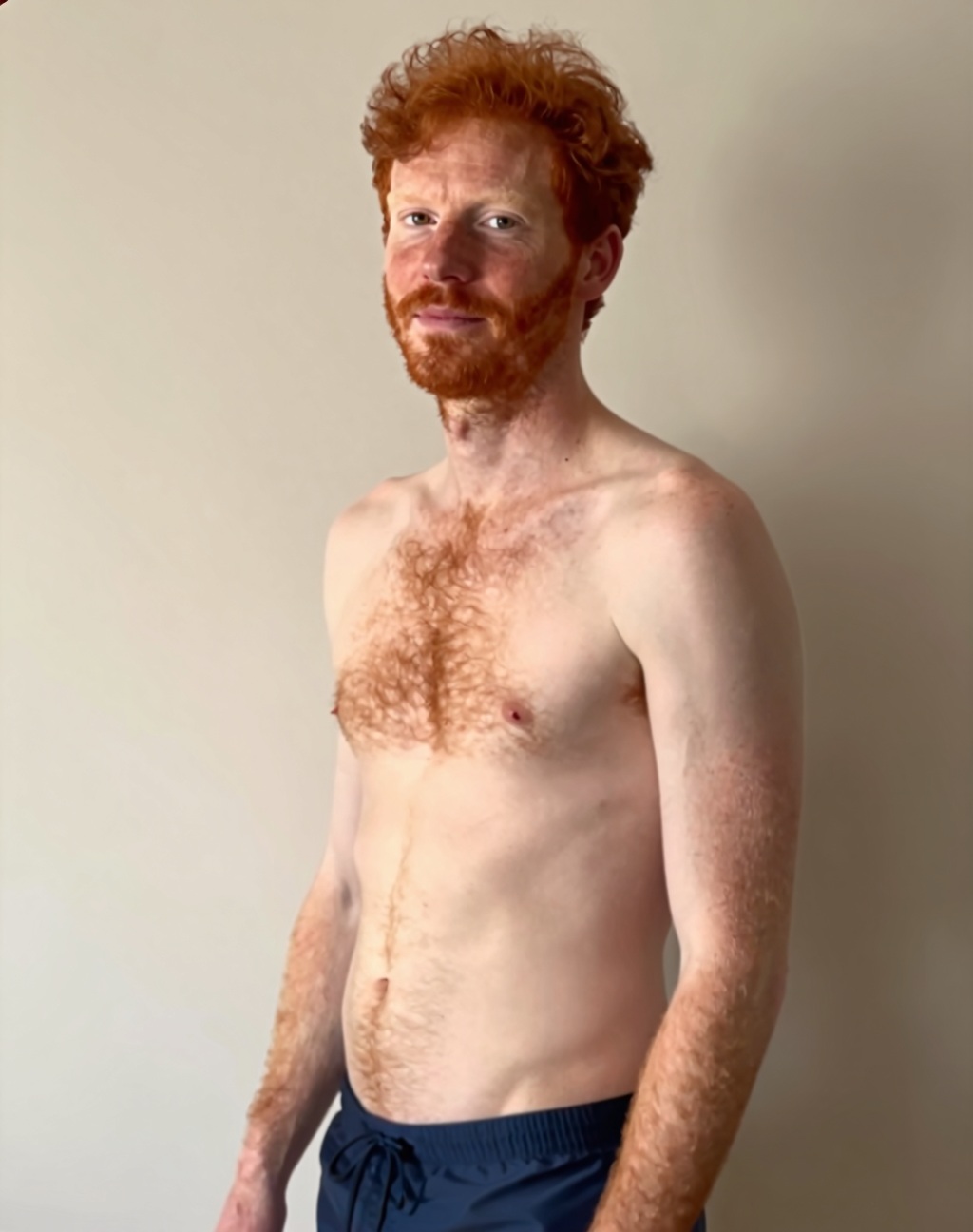 Rhedd